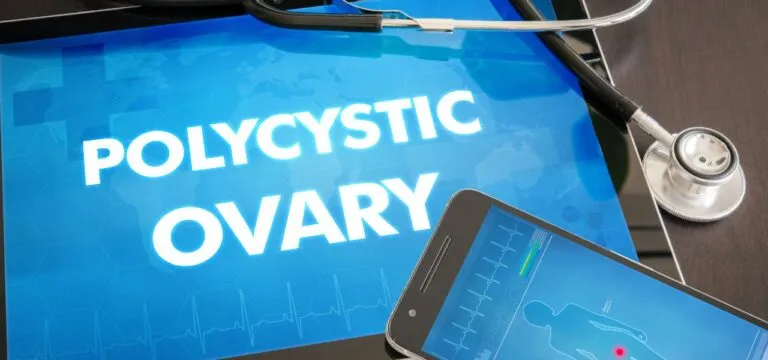 Πολυκυστικές ωοθήκες – σύνδρομο PCOS